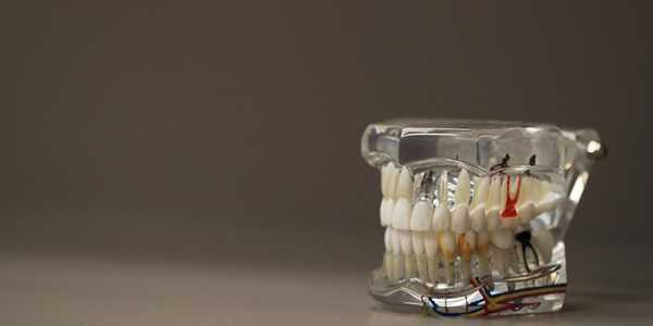 Dental Insurance For Retirees: What Are Your Options
